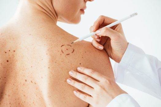 Remboursement d'un consultation chez le dermatologue